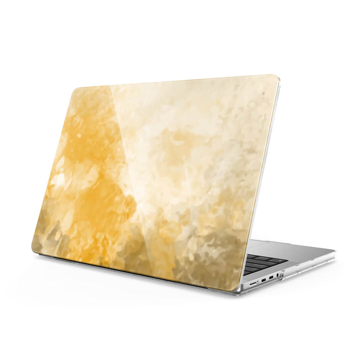 Bosque de Otoño | Funda protectora anticaída para Macbook