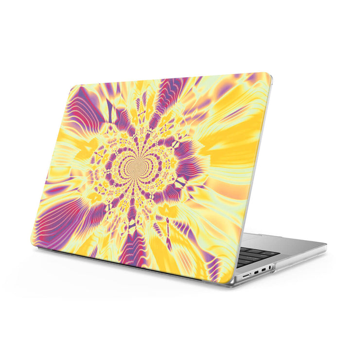 Queen | Macbook Anti-Fall Protective Case