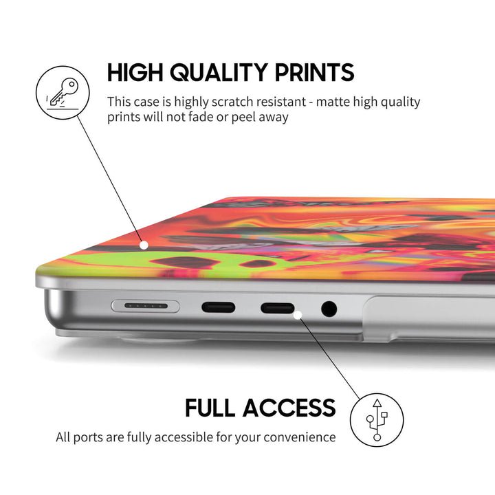 クイーン | Macbook 落下防止保護ケース